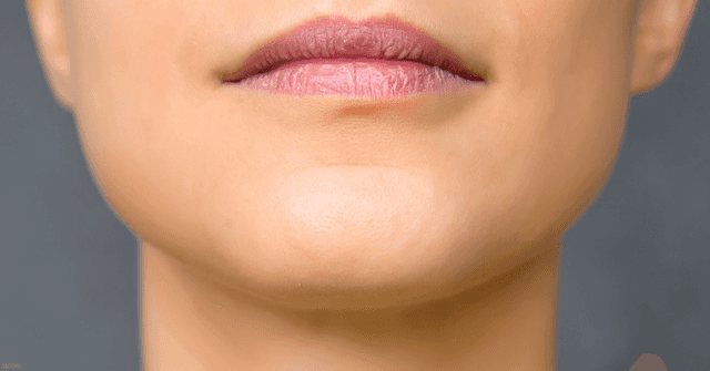 Find out out laser, light, and energy treatments in Naples, FL.