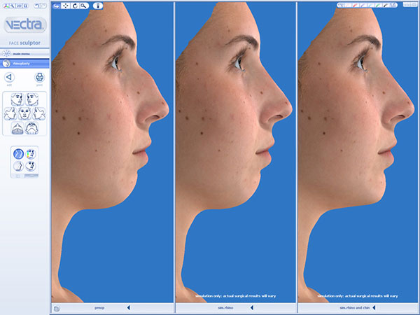 Face 3D simulation