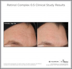 Retinol_05_CS_Female_Age54